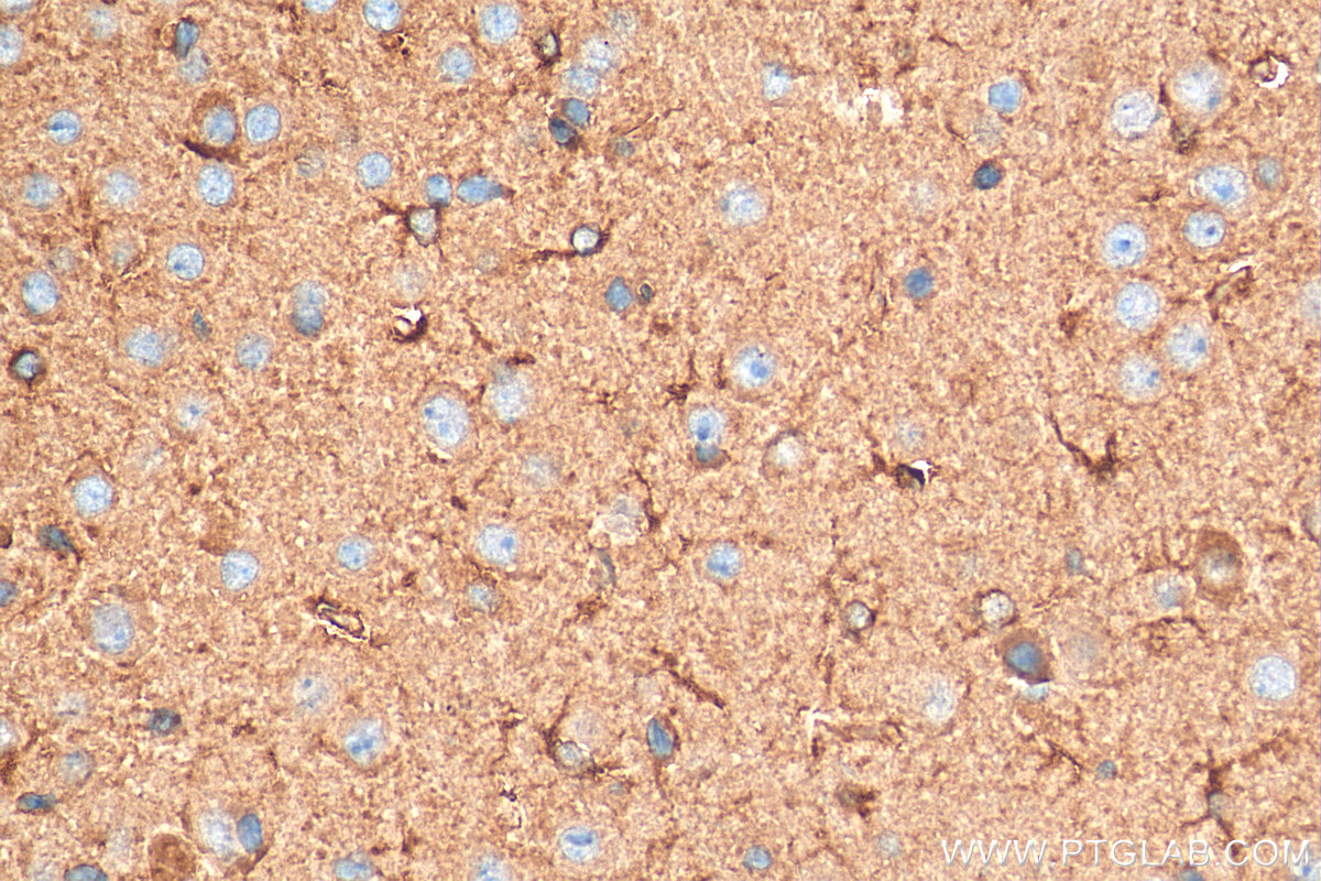 Immunohistochemistry (IHC) staining of mouse brain tissue using CEP44 Polyclonal antibody (24457-1-AP)