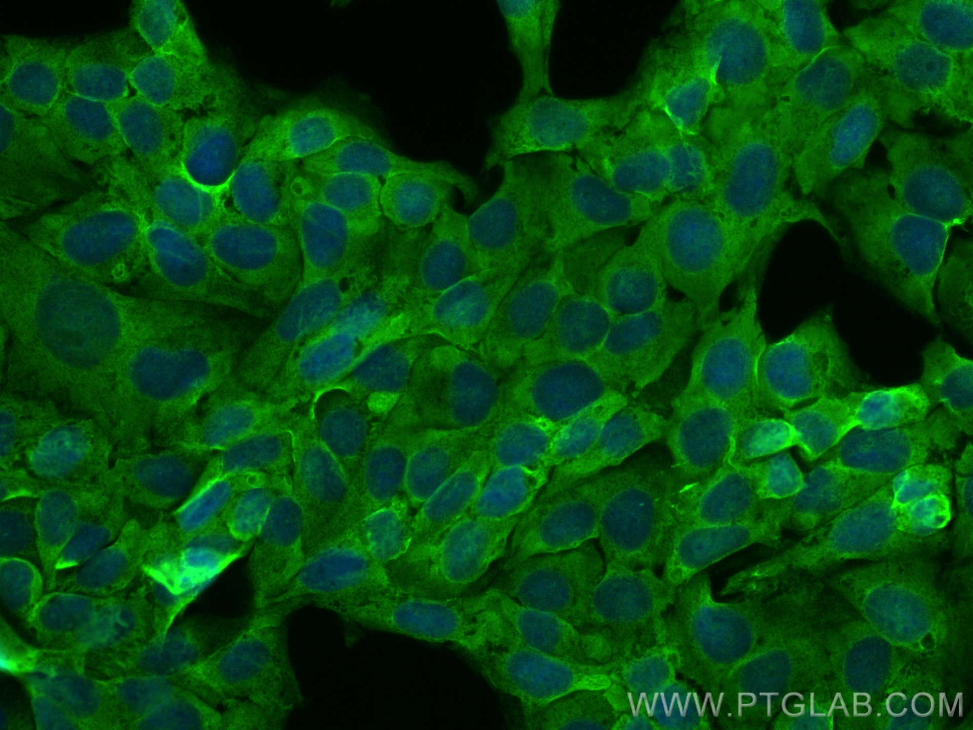 Immunofluorescence (IF) / fluorescent staining of U2OS cells using KIAA1715 Polyclonal antibody (31308-1-AP)