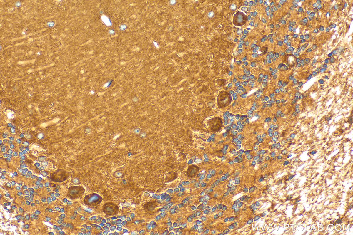 Immunohistochemistry (IHC) staining of mouse cerebellum tissue using KIAA1715 Polyclonal antibody (31308-1-AP)