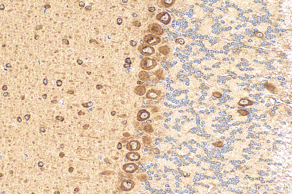 Immunohistochemistry (IHC) staining of mouse cerebellum tissue using KIAA1715 Recombinant antibody (83418-4-RR)