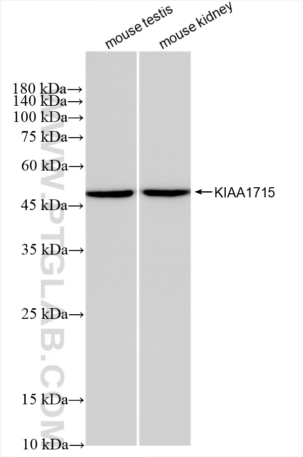 Western Blot (WB) analysis of various lysates using KIAA1715 Recombinant antibody (83418-4-RR)