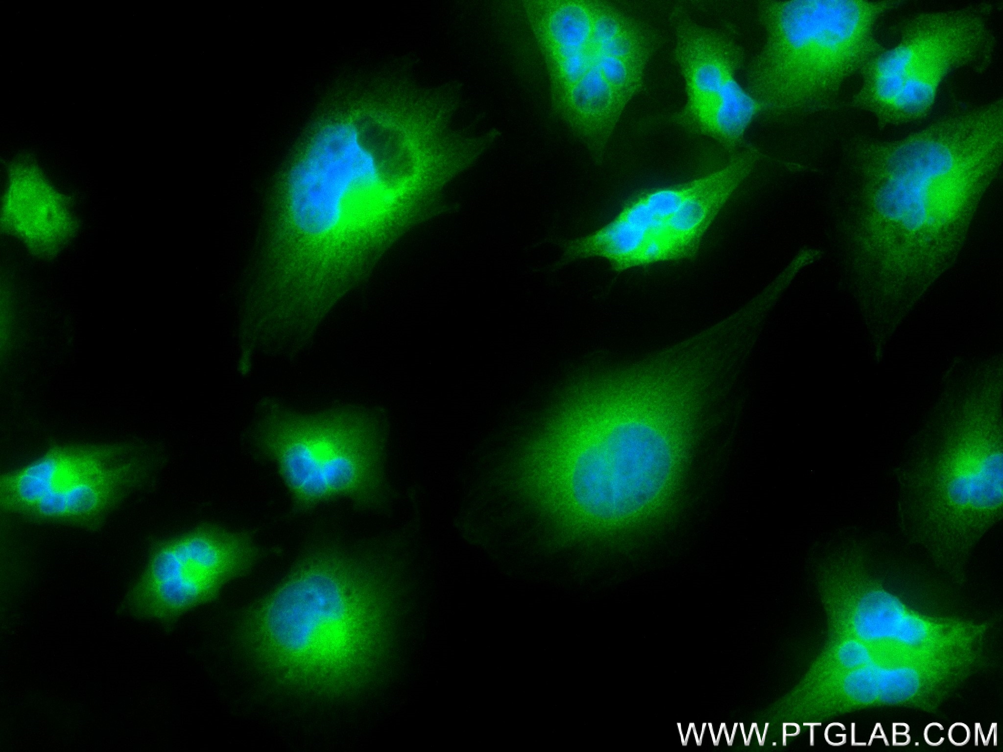 Immunofluorescence (IF) / fluorescent staining of U-251 cells using KIAA1715 Recombinant antibody (83418-5-RR)