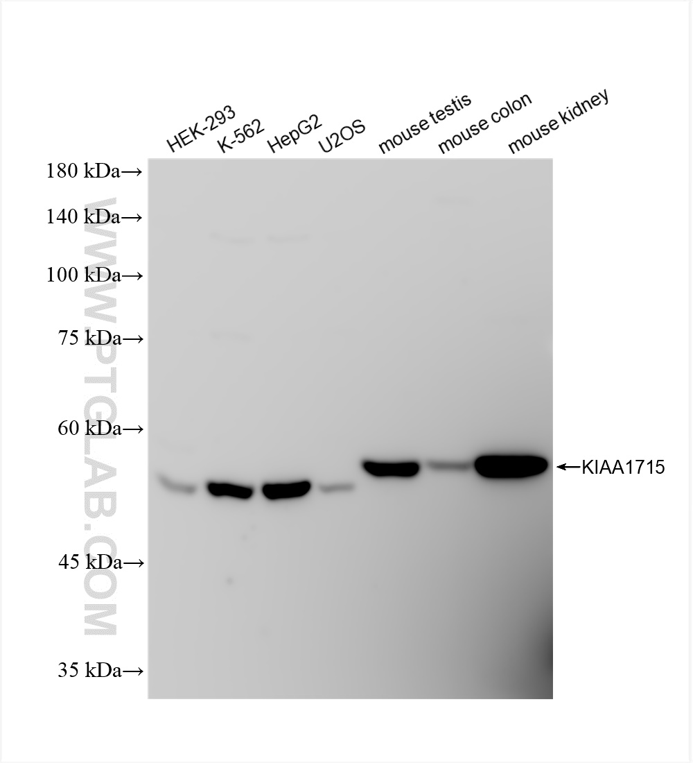 Western Blot (WB) analysis of various lysates using KIAA1715 Recombinant antibody (83418-5-RR)