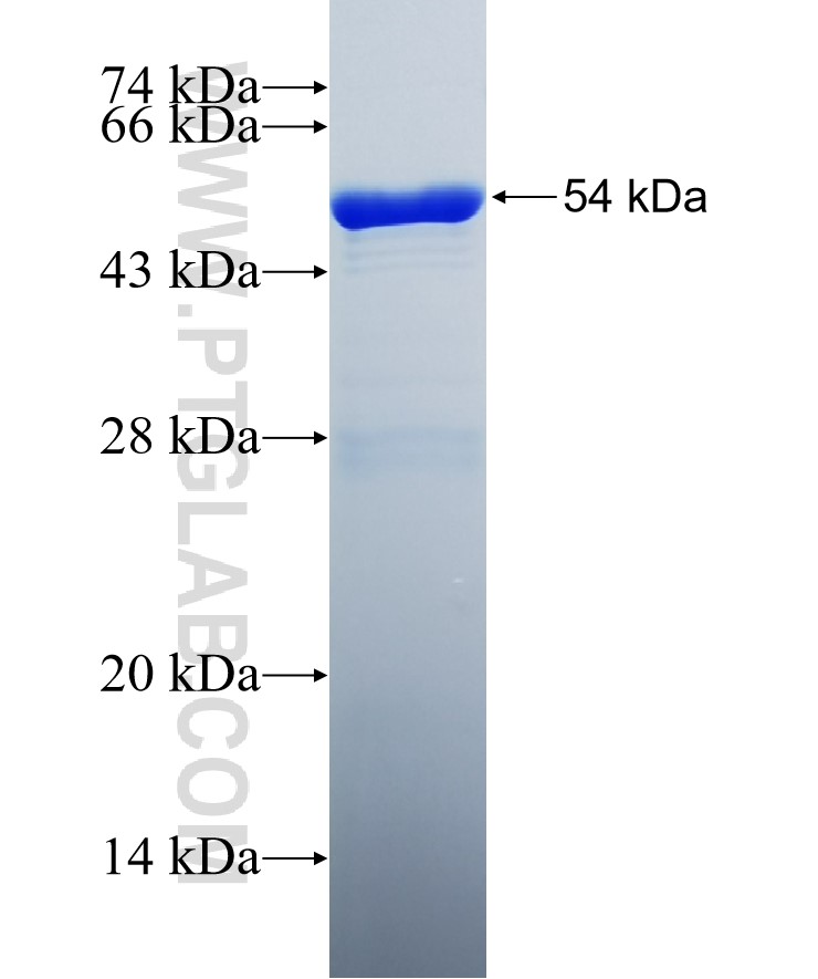 KIAA1715 fusion protein Ag34669 SDS-PAGE