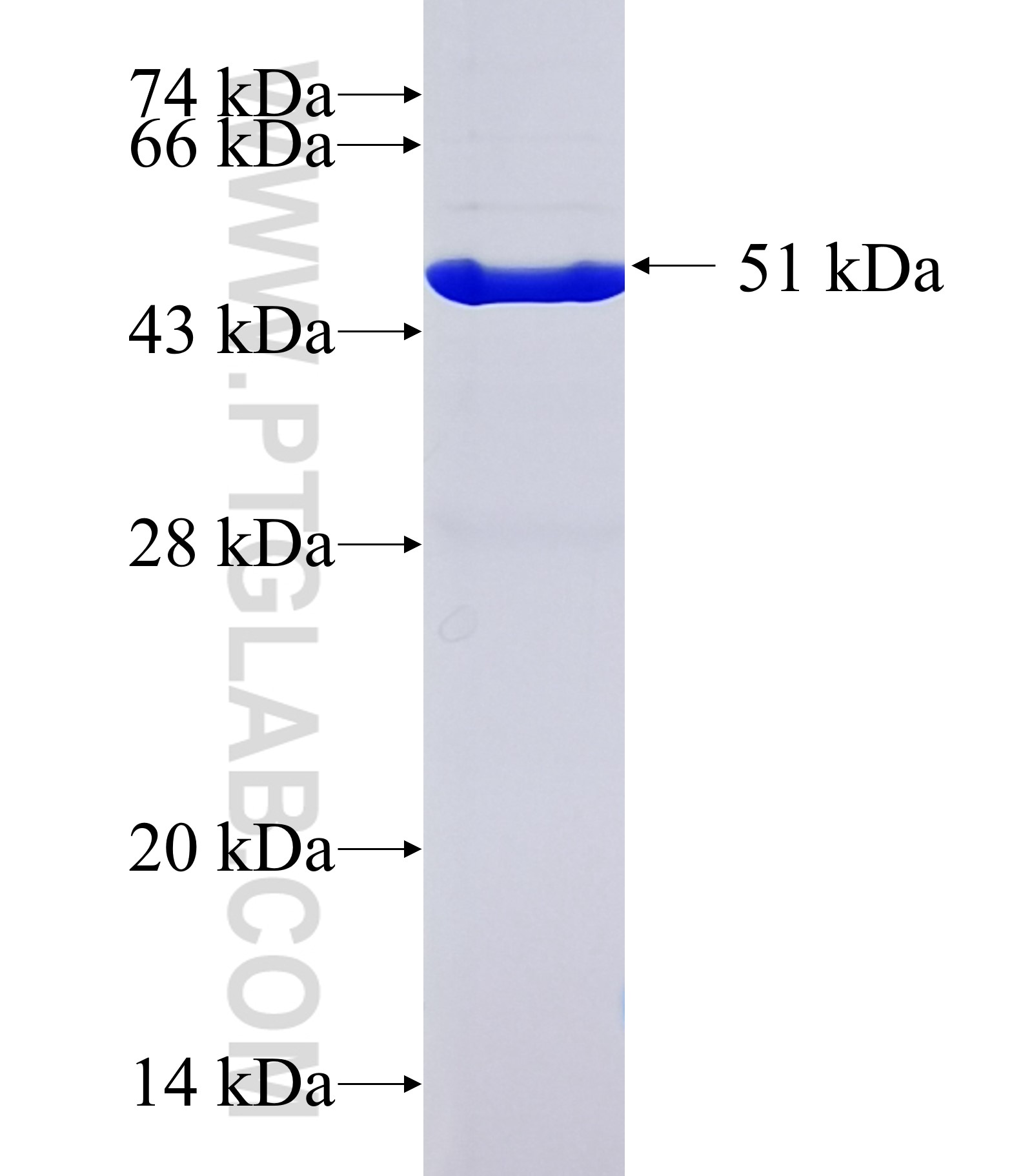 KIAA1958 fusion protein Ag29342 SDS-PAGE