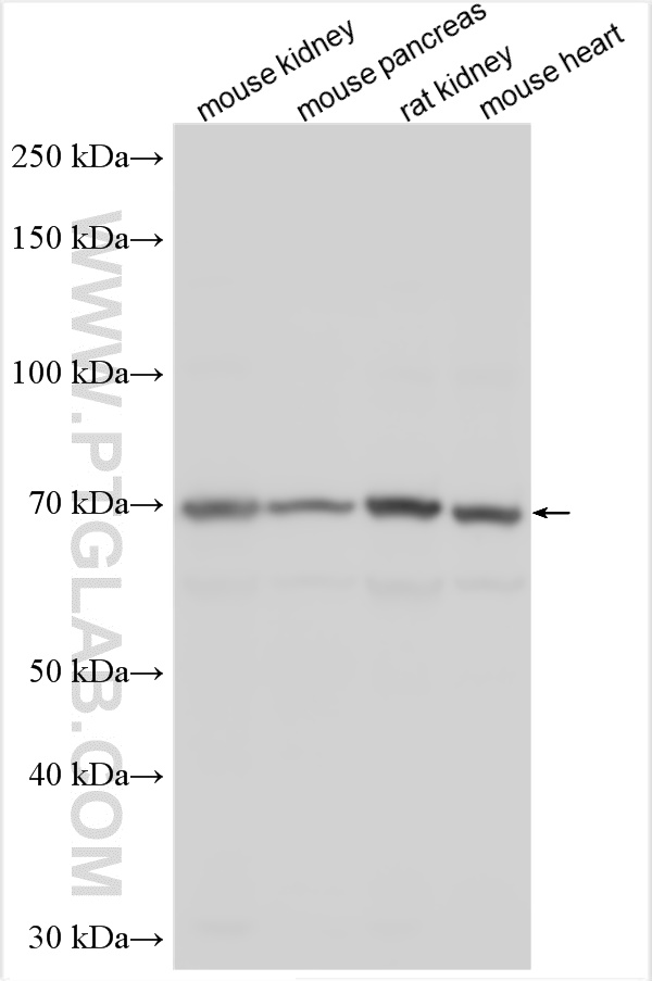 Western Blot (WB) analysis of various lysates using KIF12 Polyclonal antibody (12035-1-AP)