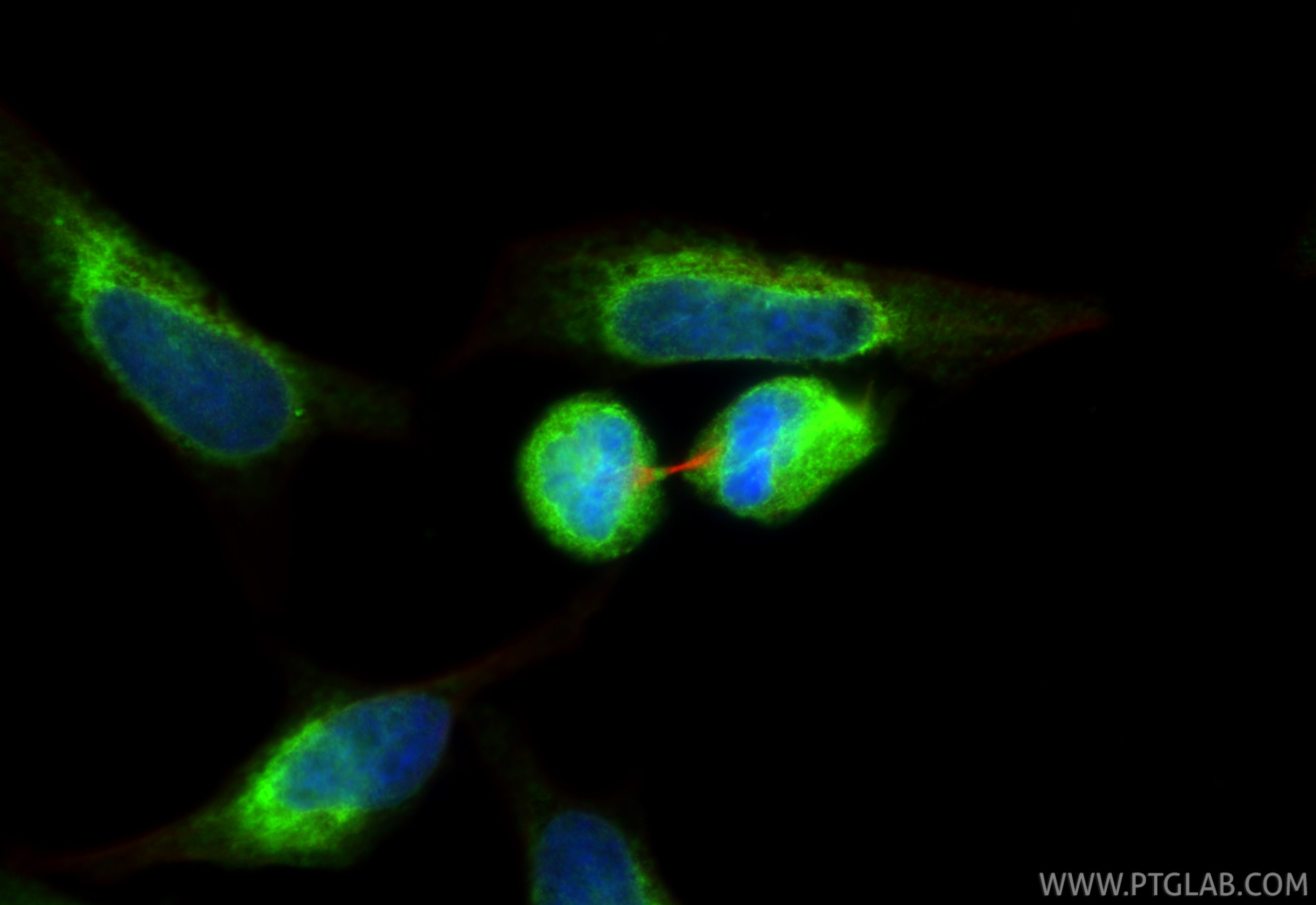 Immunofluorescence (IF) / fluorescent staining of HeLa cells using KIF17 Polyclonal antibody (14615-1-AP)