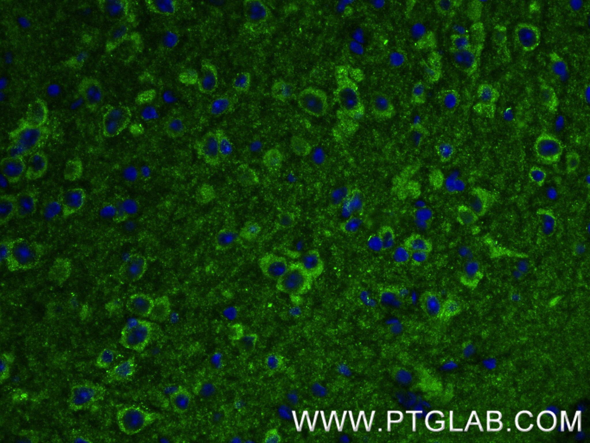 Immunofluorescence (IF) / fluorescent staining of mouse brain tissue using KIF17 Recombinant antibody (85046-1-RR)
