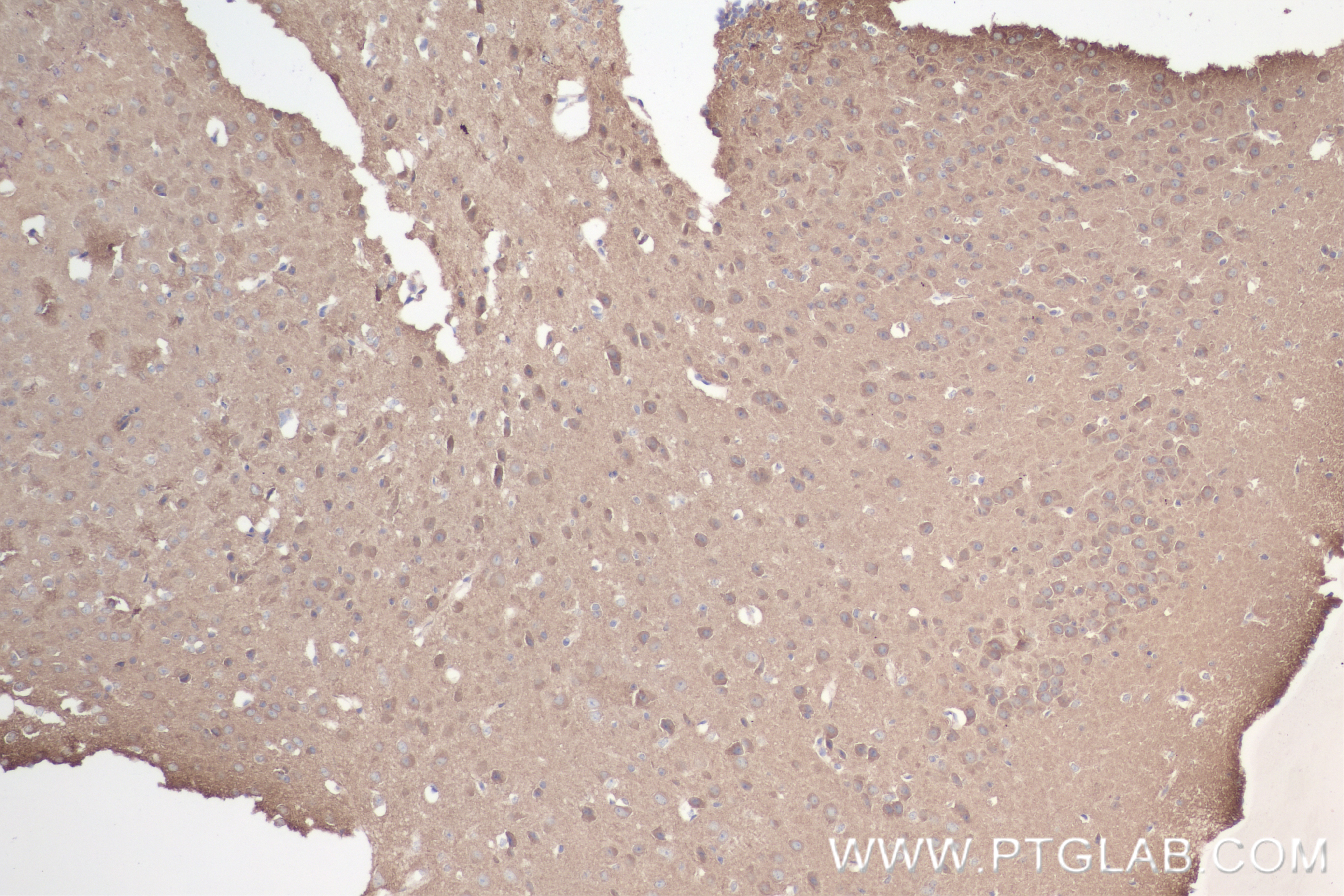 Immunohistochemistry (IHC) staining of mouse brain tissue using KIF17 Recombinant antibody (85046-1-RR)