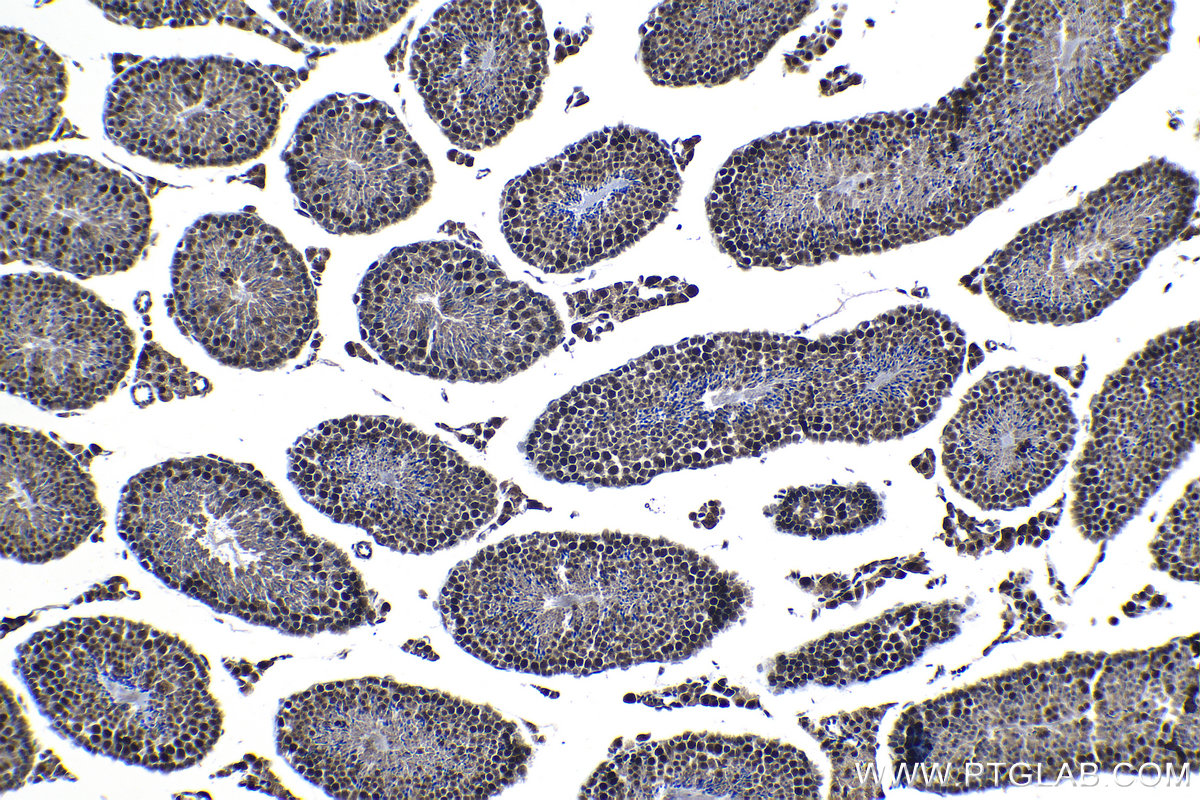 Immunohistochemistry (IHC) staining of mouse testis tissue using KIF22 Polyclonal antibody (13403-1-AP)