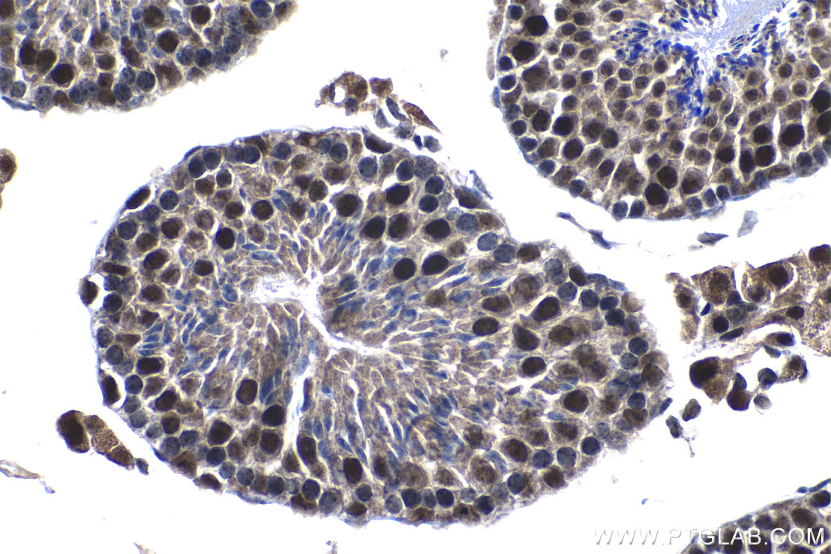 Immunohistochemistry (IHC) staining of mouse testis tissue using KIF22 Polyclonal antibody (13403-1-AP)