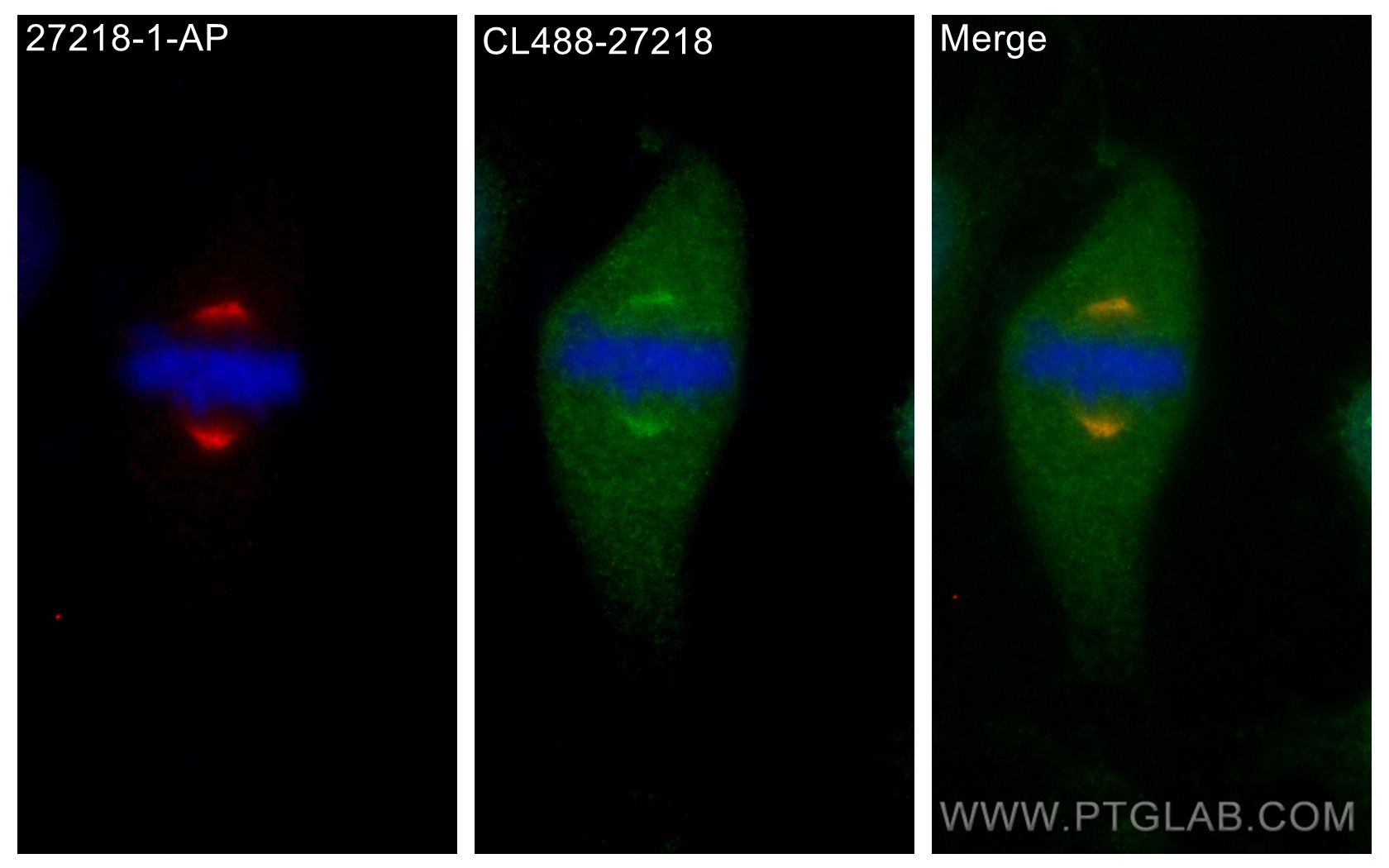 Immunofluorescence (IF) / fluorescent staining of HeLa cells using CoraLite® Plus 488-conjugated KIF2A Polyclonal ant (CL488-27218)