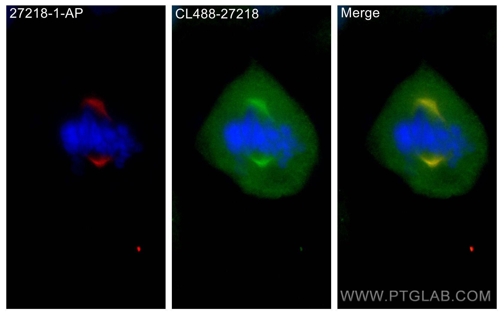 Immunofluorescence (IF) / fluorescent staining of A549 cells using CoraLite® Plus 488-conjugated KIF2A Polyclonal ant (CL488-27218)