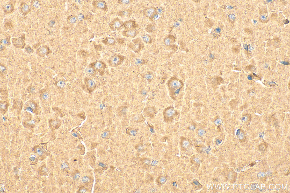 Immunohistochemistry (IHC) staining of mouse brain tissue using KIF3A Polyclonal antibody (13930-1-AP)