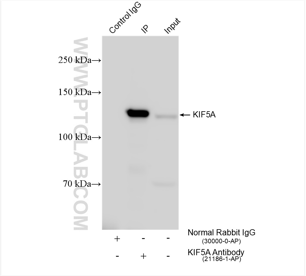 Immunoprecipitation (IP) experiment of mouse brain tissue using KIF5A Polyclonal antibody (21186-1-AP)