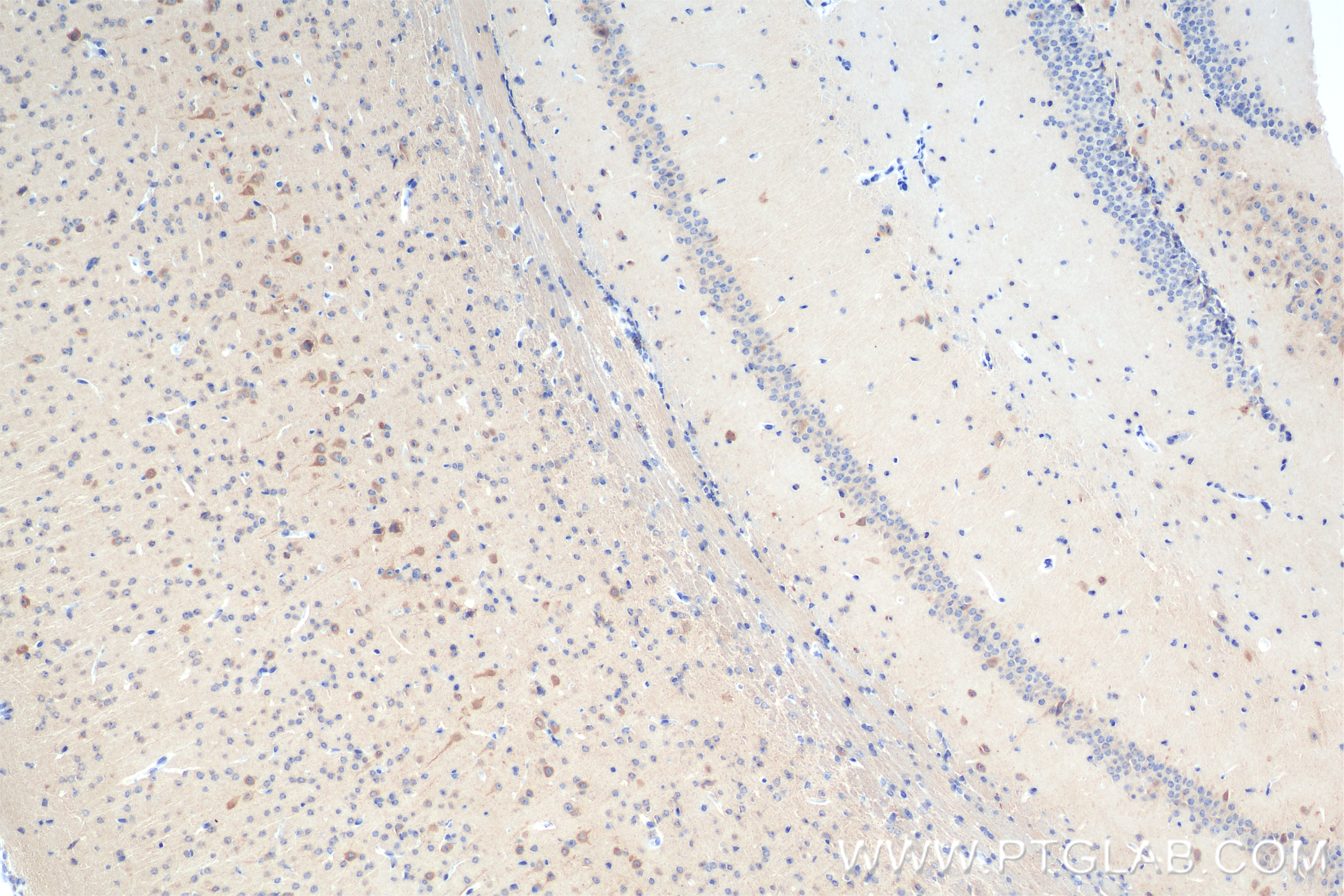 Immunohistochemistry (IHC) staining of mouse brain tissue using KIF5A Recombinant antibody (84013-4-RR)