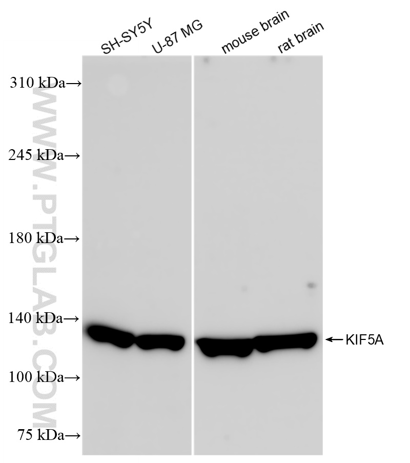 Western Blot (WB) analysis of rat brain tissue using KIF5A Recombinant antibody (84013-4-RR)