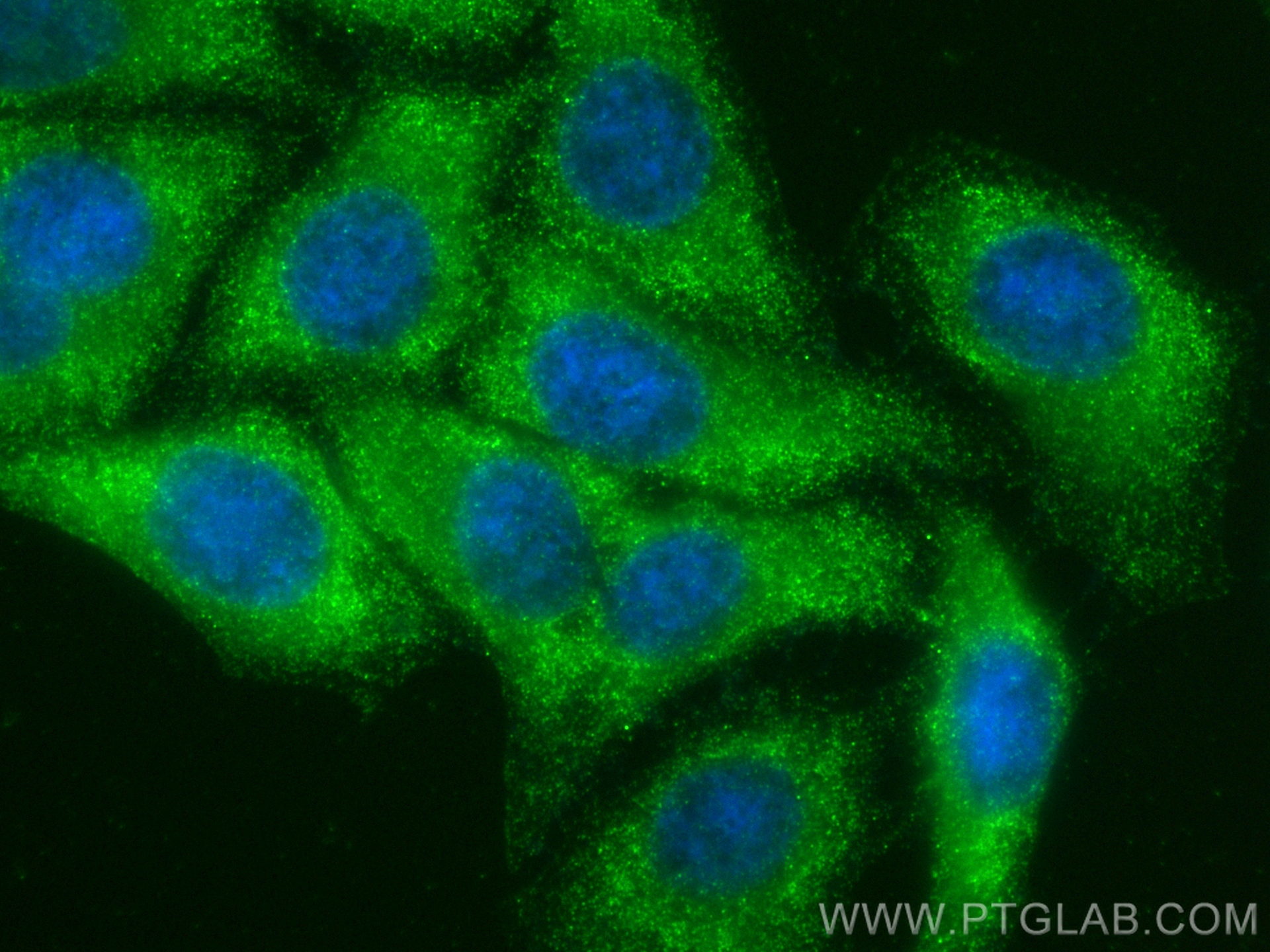 Immunofluorescence (IF) / fluorescent staining of HepG2 cells using KIF5B Recombinant antibody (82485-1-RR)