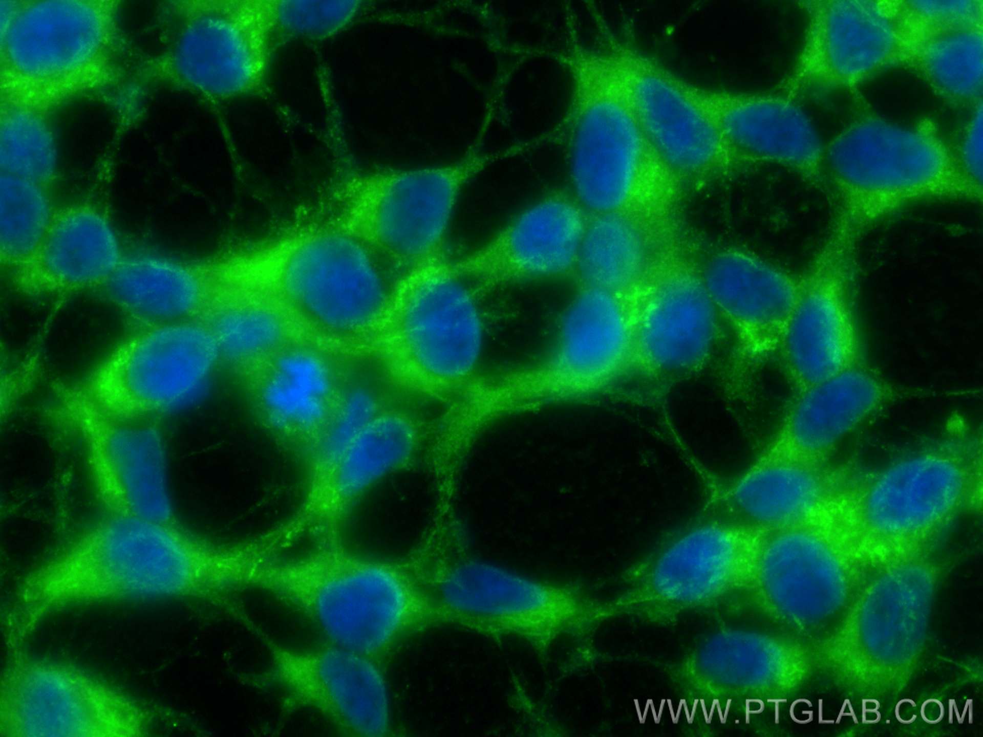 Immunofluorescence (IF) / fluorescent staining of SH-SY5Y cells using KIF5C Polyclonal antibody (25897-1-AP)