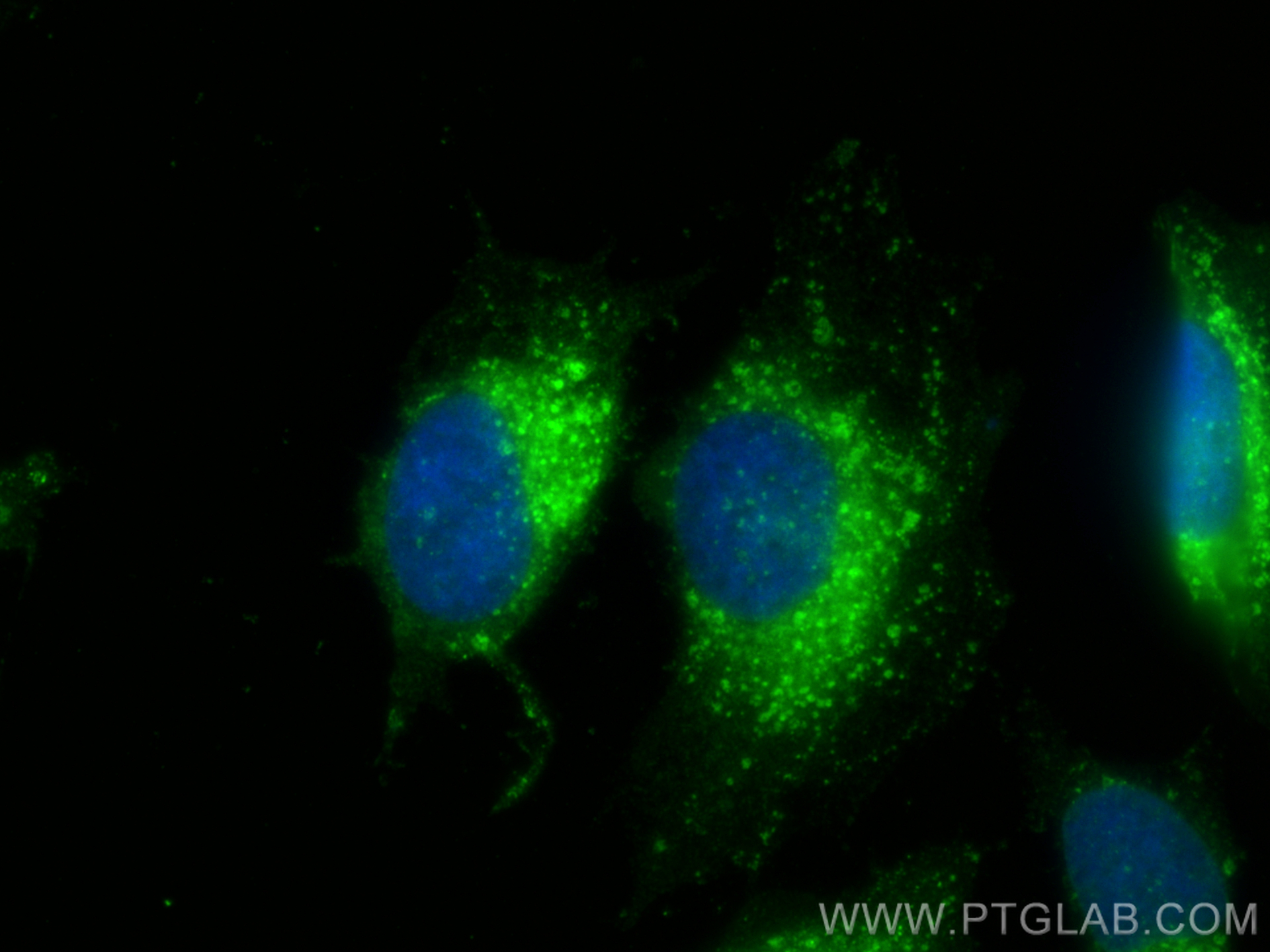 Immunofluorescence (IF) / fluorescent staining of HeLa cells using KIF5C Polyclonal antibody (25897-1-AP)