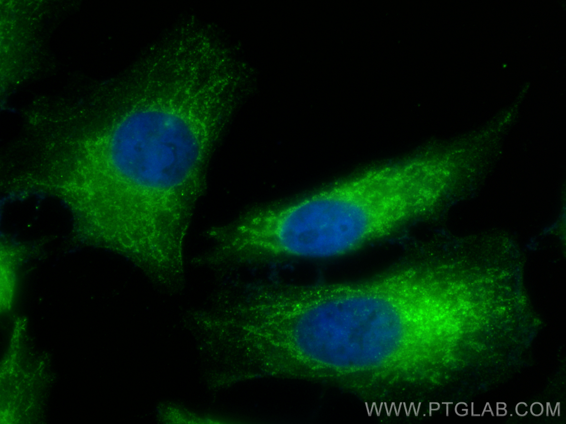 Immunofluorescence (IF) / fluorescent staining of HeLa cells using KIF5C Polyclonal antibody (25897-1-AP)