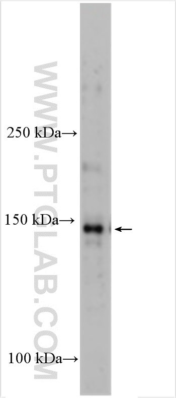 Western Blot (WB) analysis of various lysates using KIF7 Polyclonal antibody (24693-1-AP)
