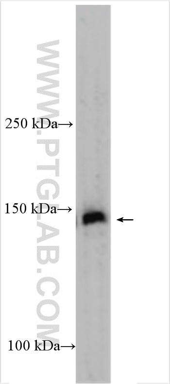 Western Blot (WB) analysis of HEK-293 cells using KIF7 Polyclonal antibody (24693-1-AP)
