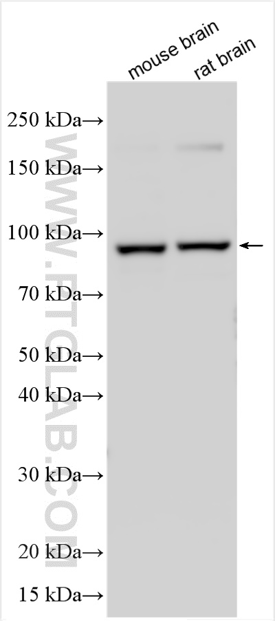 Western Blot (WB) analysis of mouse brain tissue using KIFC2 Polyclonal antibody (27470-1-AP)