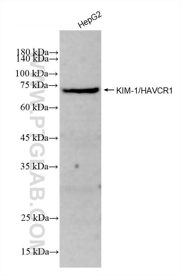 Western Blot (WB) analysis of various lysates using KIM-1/HAVCR1 Recombinant antibody (83221-2-RR)