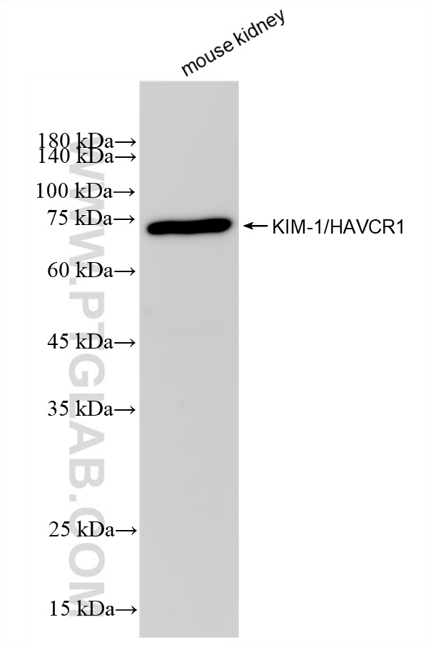 Western Blot (WB) analysis of various lysates using KIM-1/HAVCR1 Recombinant antibody (83221-2-RR)