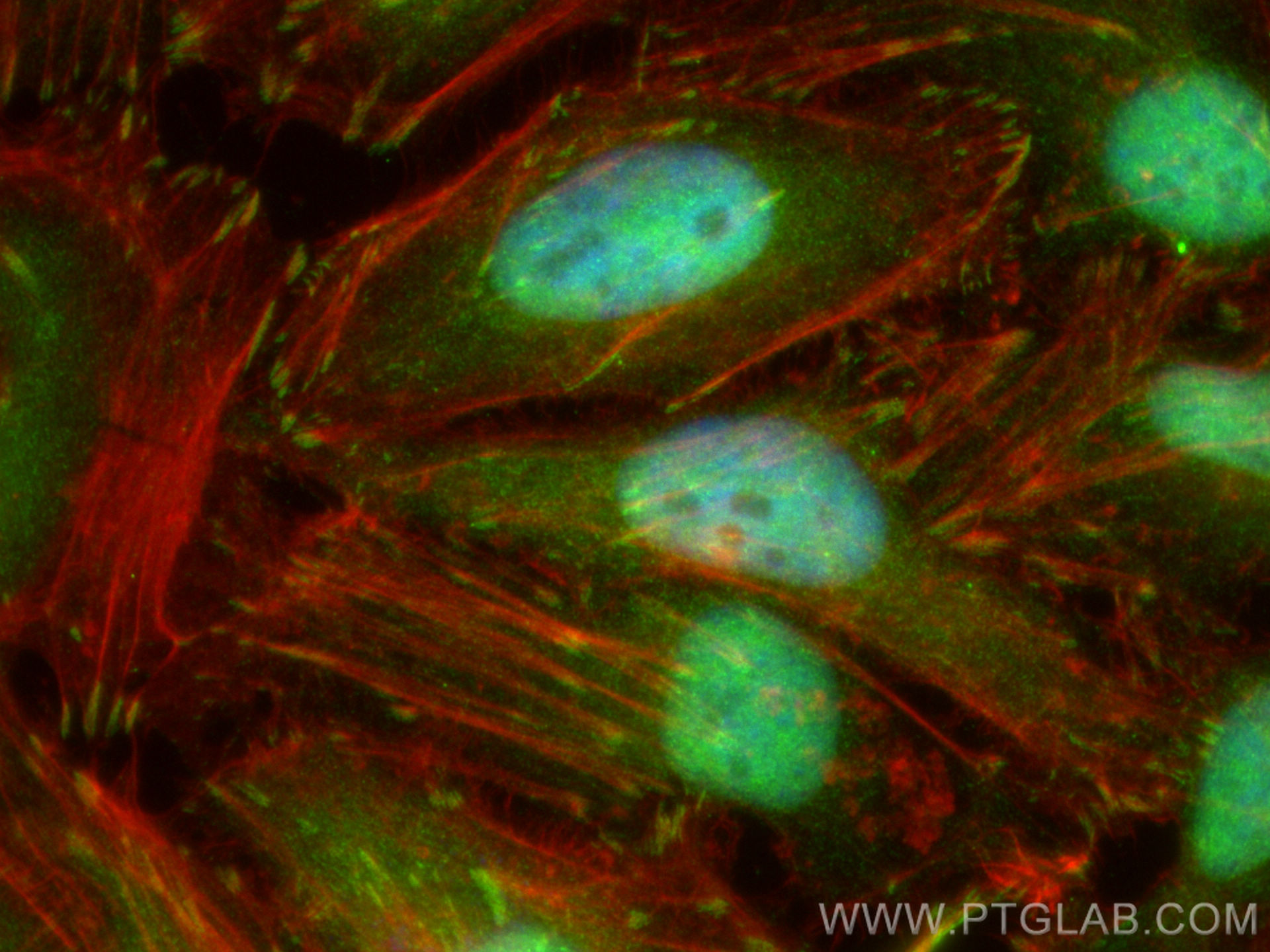 Immunofluorescence (IF) / fluorescent staining of HeLa cells using KIN17 Polyclonal antibody (12313-1-AP)