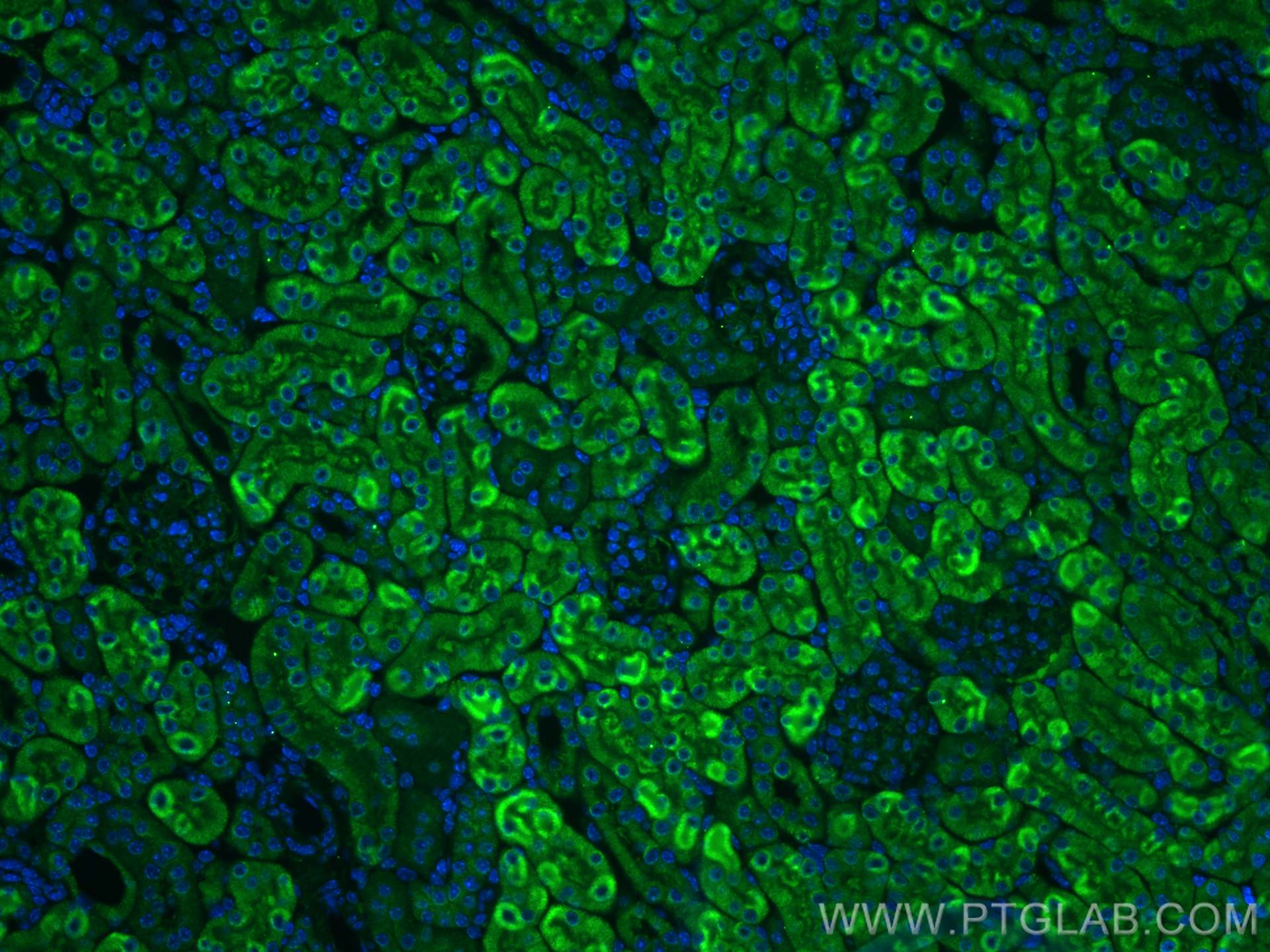 Immunofluorescence (IF) / fluorescent staining of mouse kidney tissue using KIRREL Polyclonal antibody (22232-1-AP)