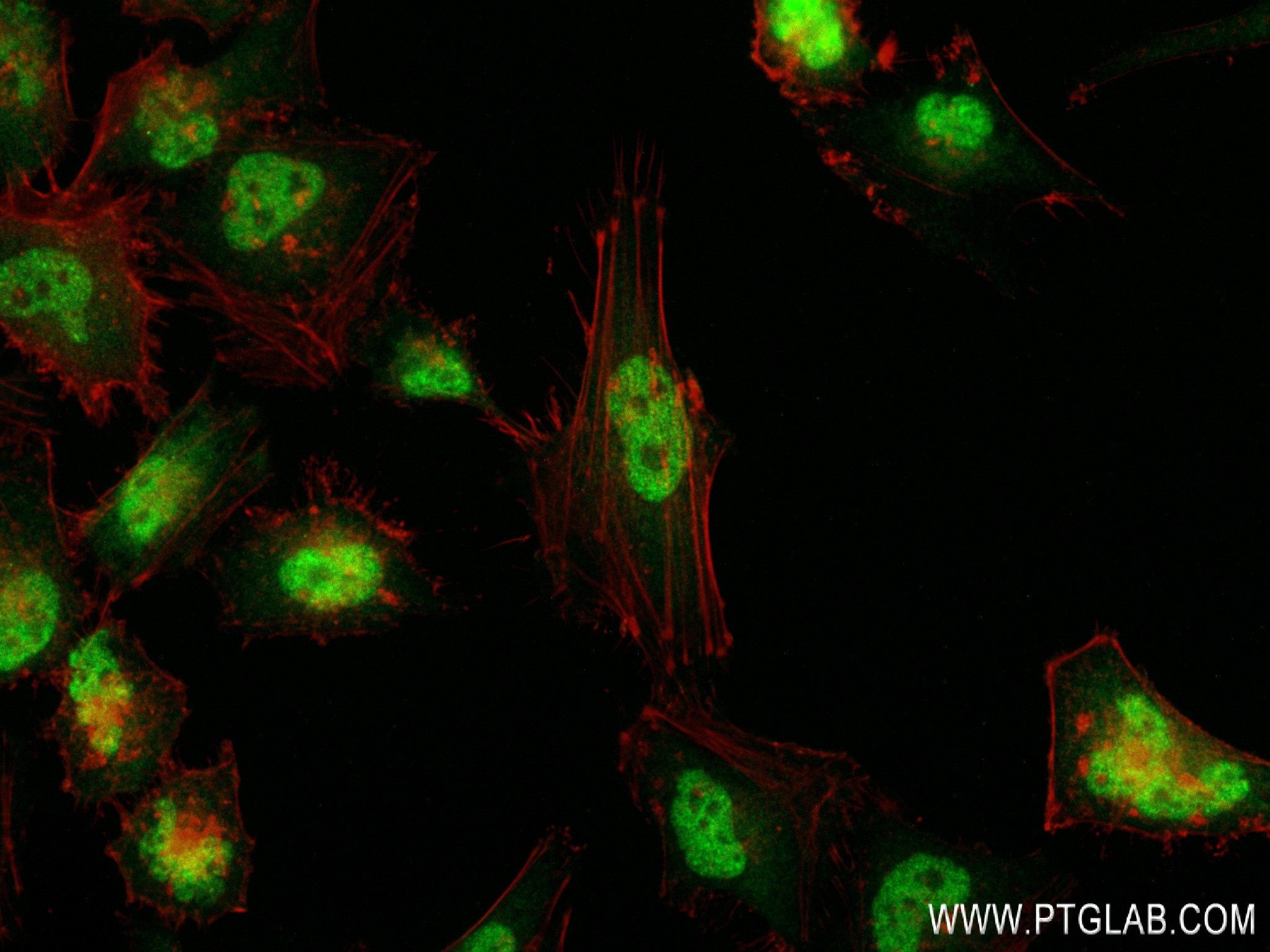 Immunofluorescence (IF) / fluorescent staining of HeLa cells using KLF5 Recombinant antibody (83205-4-RR)