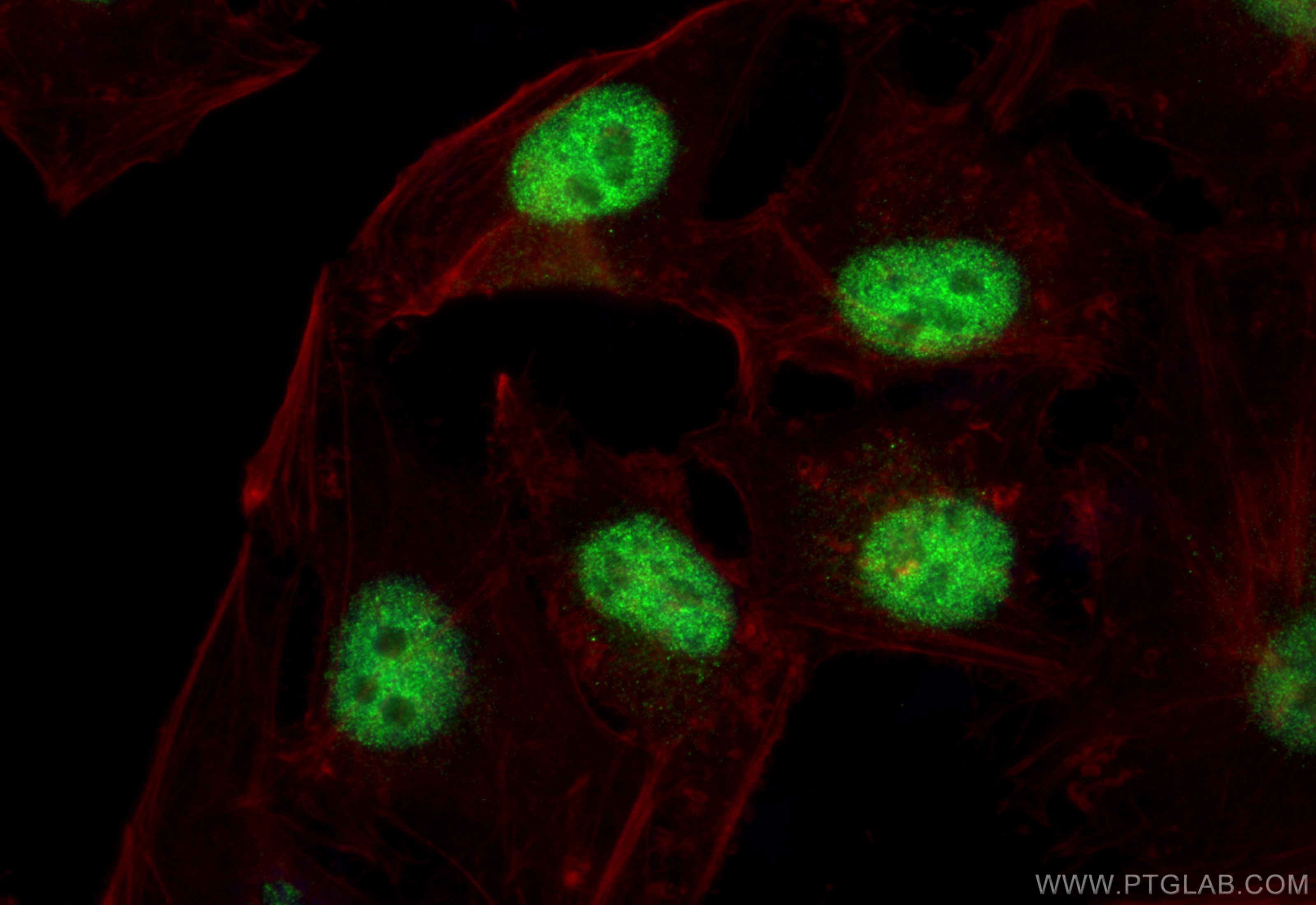 Immunofluorescence (IF) / fluorescent staining of HeLa cells using KLF5 Recombinant antibody (83205-4-RR)