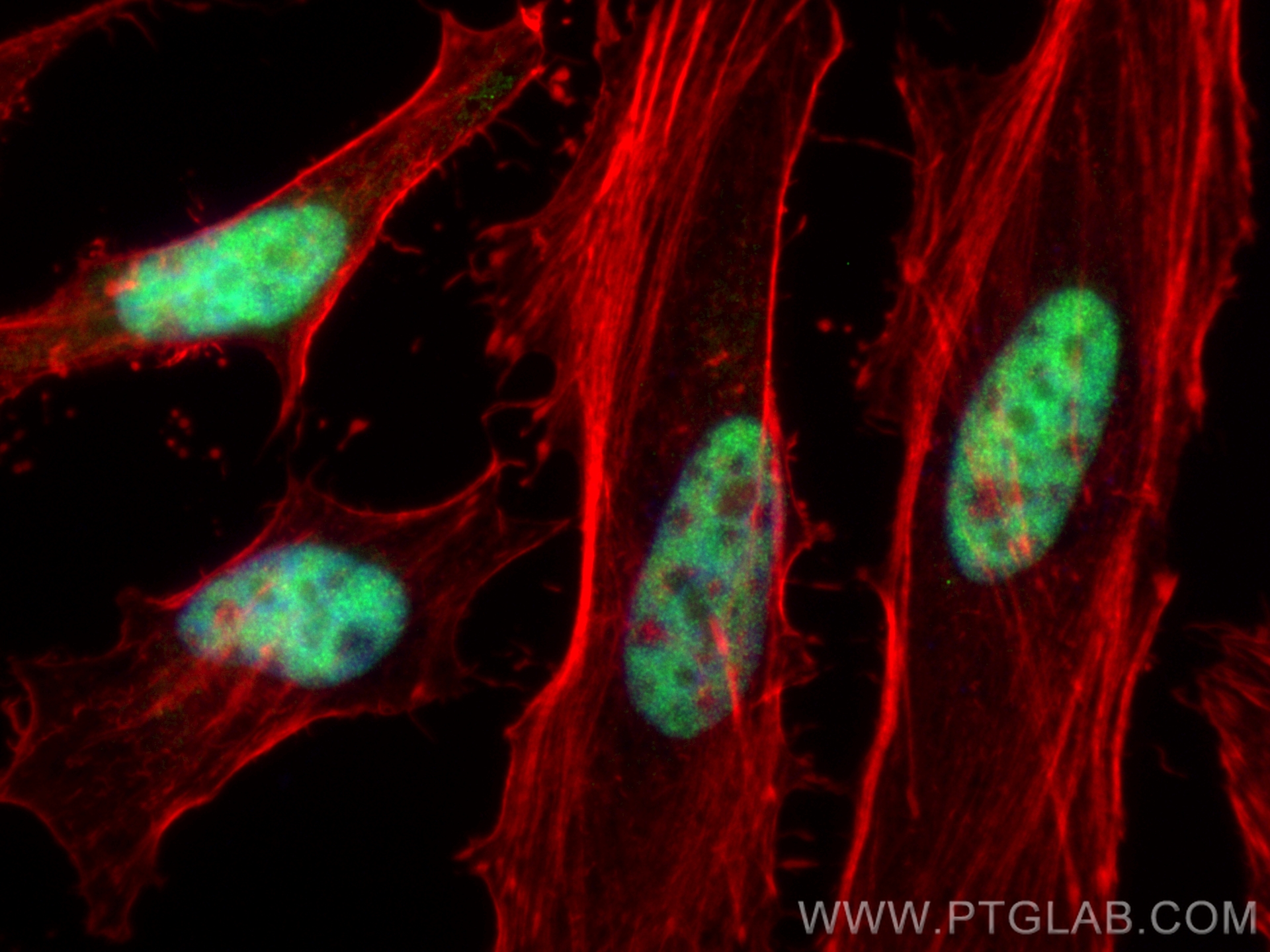 Immunofluorescence (IF) / fluorescent staining of HeLa cells using CoraLite® Plus 488-conjugated KLF5 Polyclonal anti (CL488-21017)