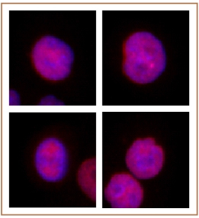 KLF5 antibody (pAb) tested by Immunofluorescence. Formaldehyde fixed HeLa cells stained with KLF5 antibody at a 1:2,000 dilution.