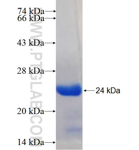 KLHDC1 fusion protein Ag23704 SDS-PAGE