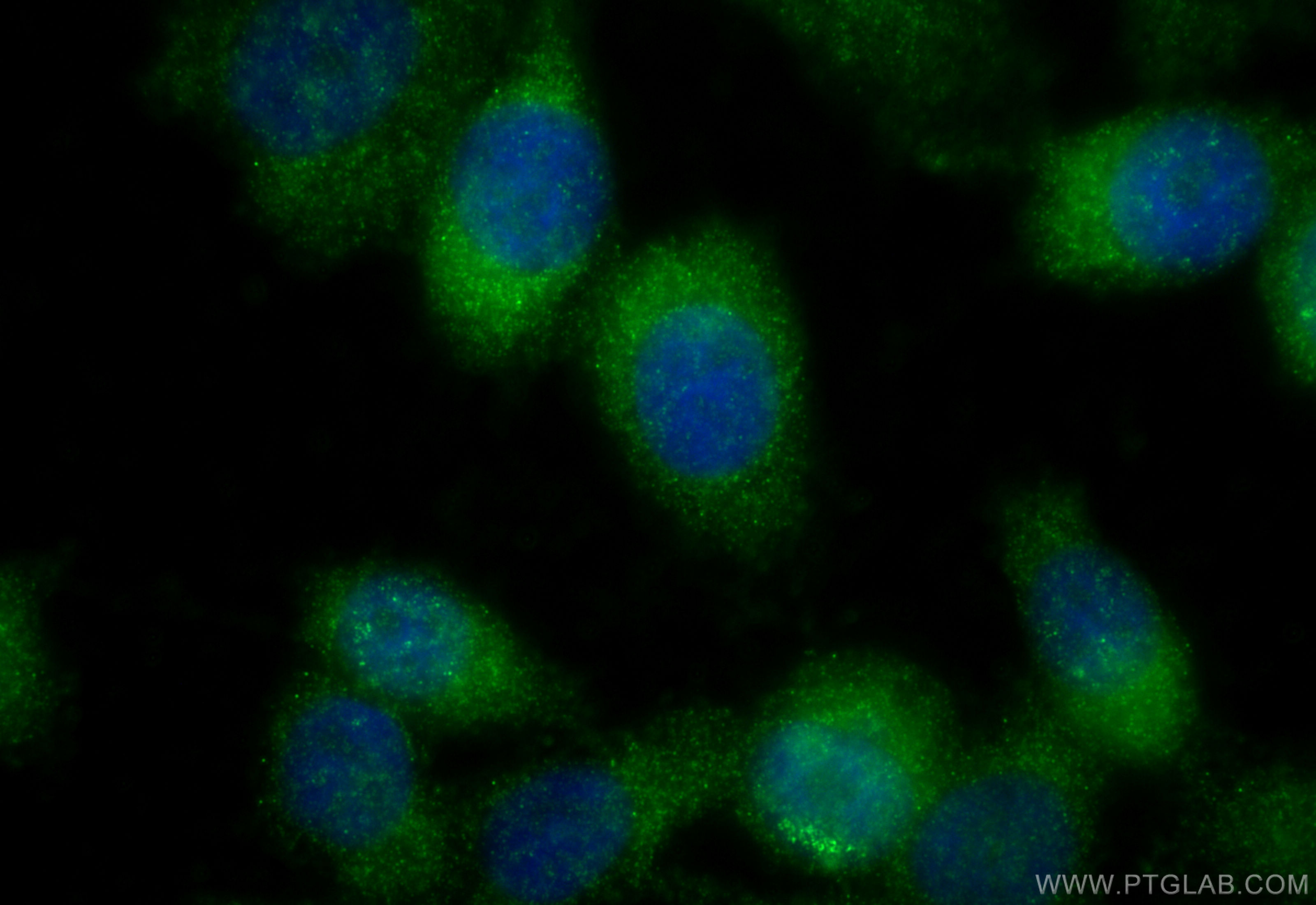 Immunofluorescence (IF) / fluorescent staining of PC-3 cells using KLHDC3 Polyclonal antibody (13905-1-AP)