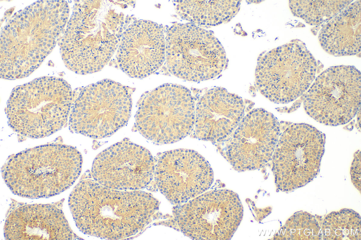 Immunohistochemistry (IHC) staining of mouse testis tissue using KLHDC3 Polyclonal antibody (13905-1-AP)