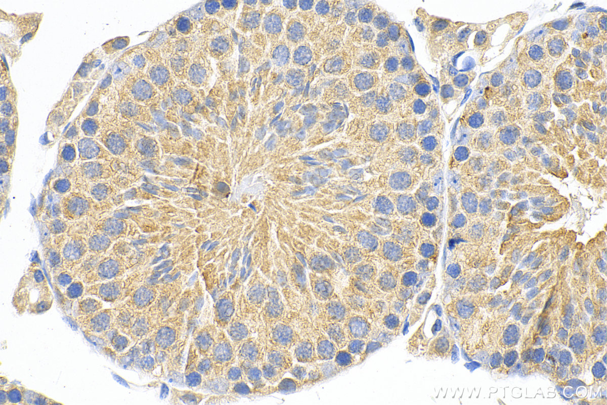 Immunohistochemistry (IHC) staining of mouse testis tissue using KLHDC3 Polyclonal antibody (13905-1-AP)