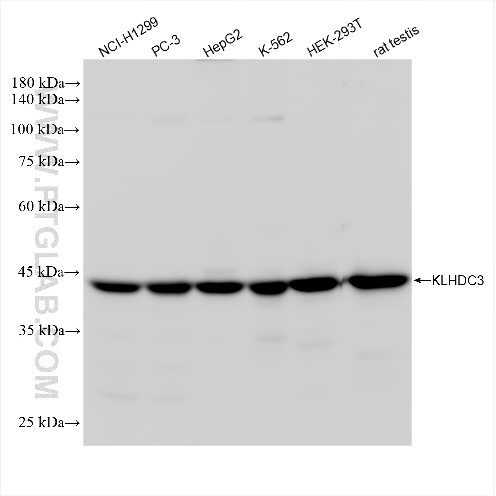 Western Blot (WB) analysis of various lysates using KLHDC3 Recombinant antibody (84217-4-RR)