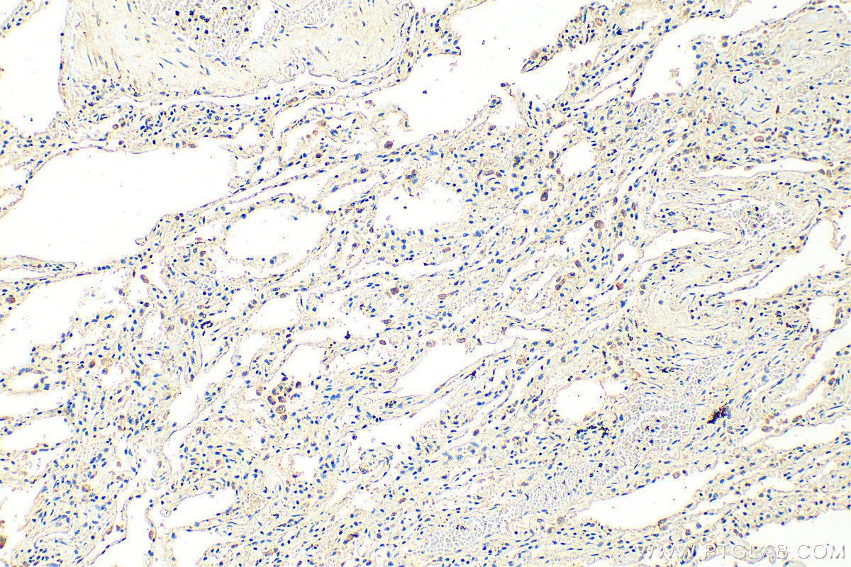 Immunohistochemistry (IHC) staining of human lung tissue using KLHL13 Polyclonal antibody (15612-1-AP)