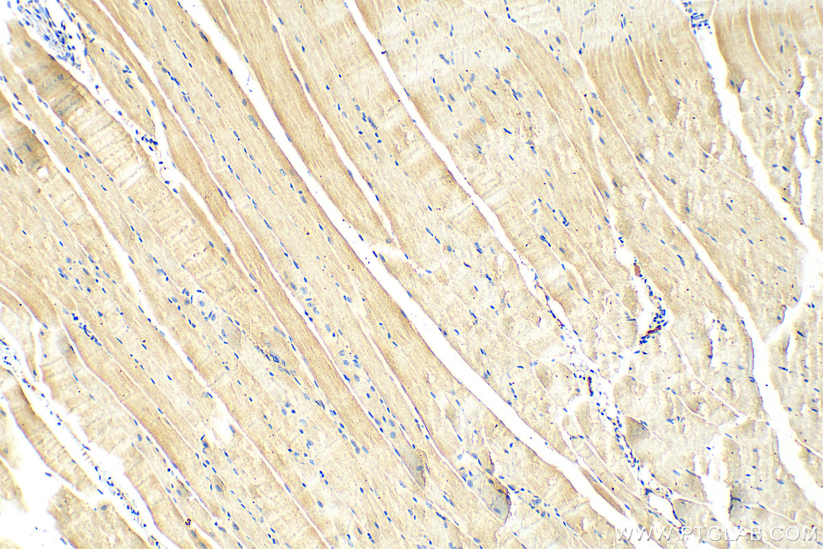 Immunohistochemistry (IHC) staining of mouse skeletal muscle tissue using KLHL13 Polyclonal antibody (15612-1-AP)