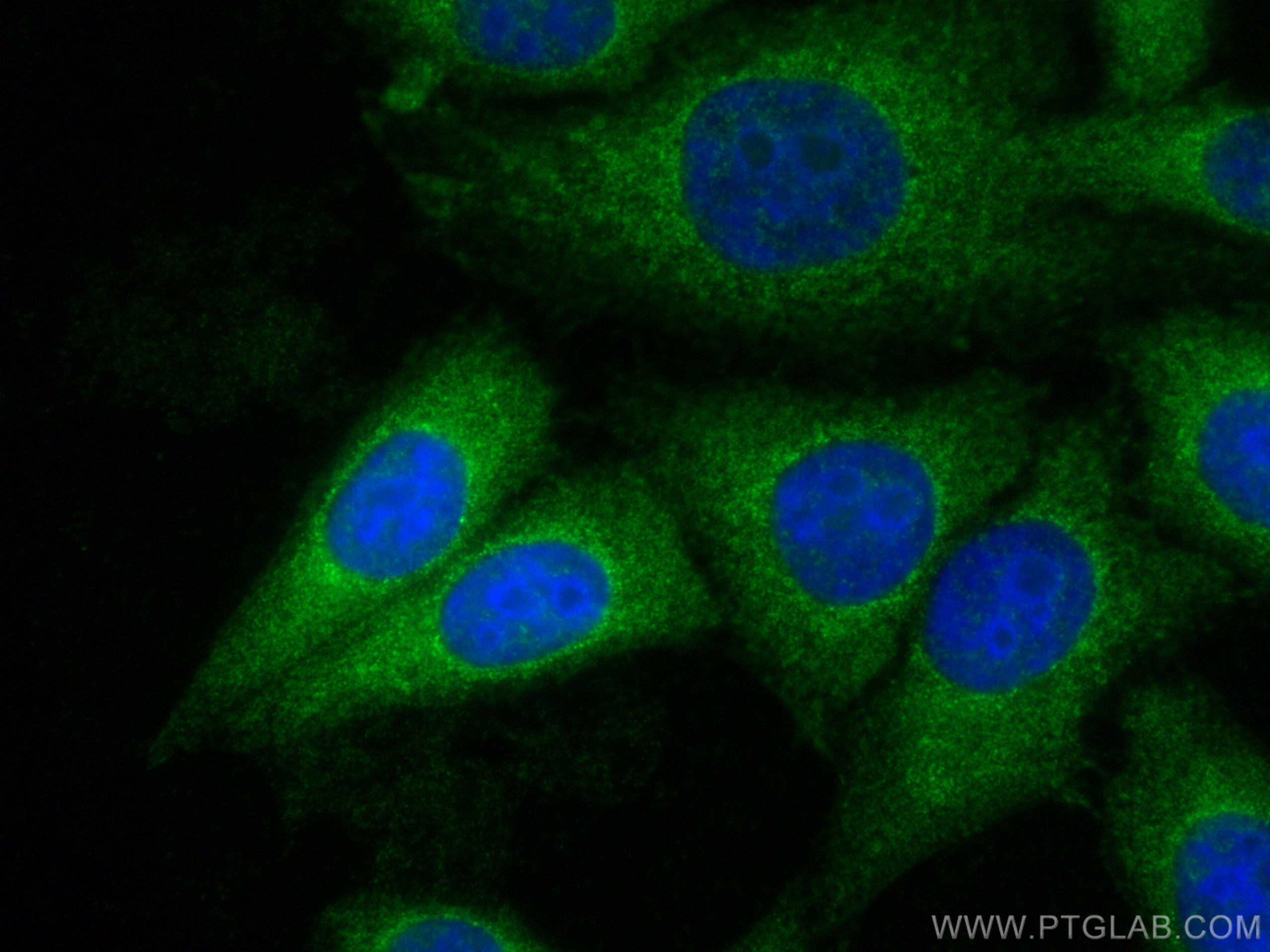 Immunofluorescence (IF) / fluorescent staining of HepG2 cells using KLHL14 Polyclonal antibody (29253-1-AP)