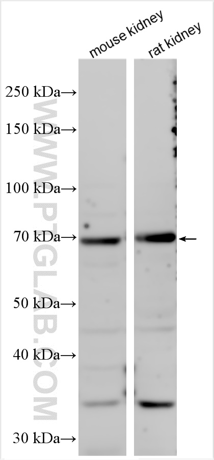 Western Blot (WB) analysis of various lysates using KLHL14 Polyclonal antibody (29253-1-AP)