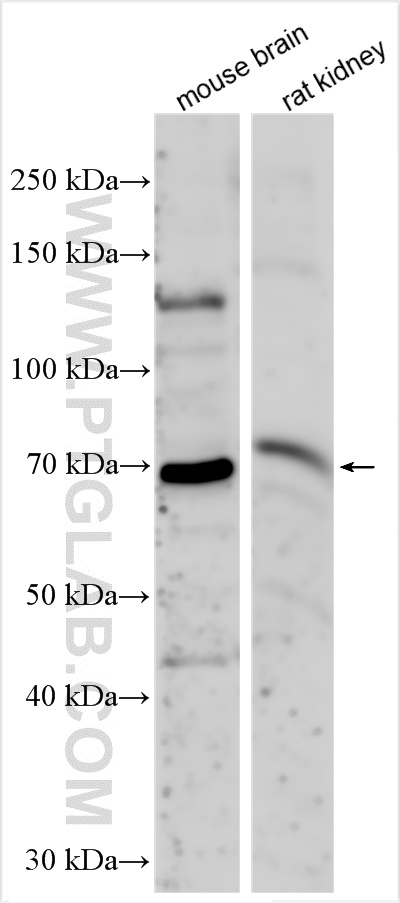 Western Blot (WB) analysis of mouse brain tissue using KLHL14 Polyclonal antibody (29253-1-AP)