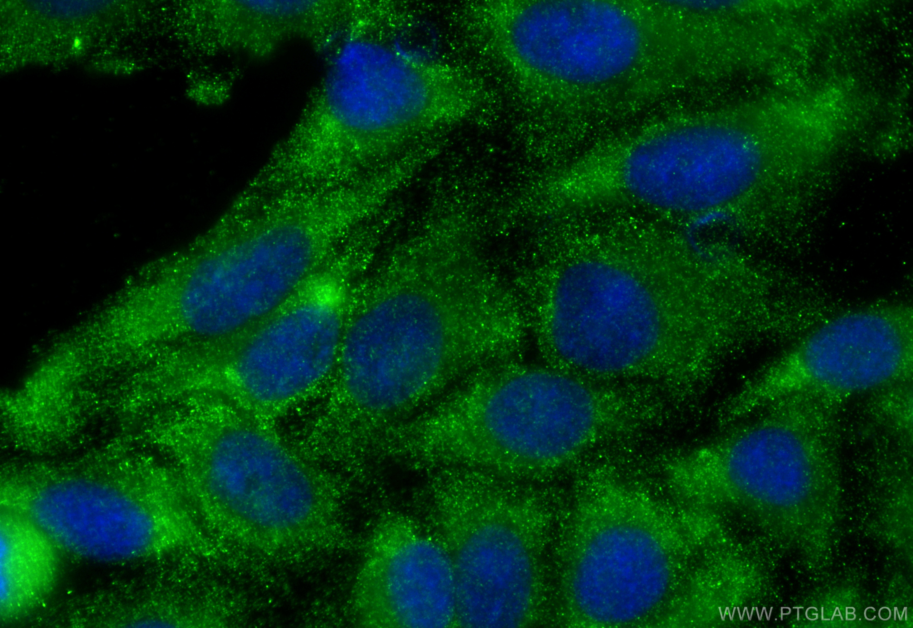 Immunofluorescence (IF) / fluorescent staining of HepG2 cells using KLHL14-Specific Polyclonal antibody (14849-1-AP)