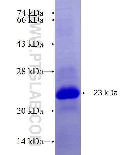 KLHL24 fusion protein Ag27199 SDS-PAGE