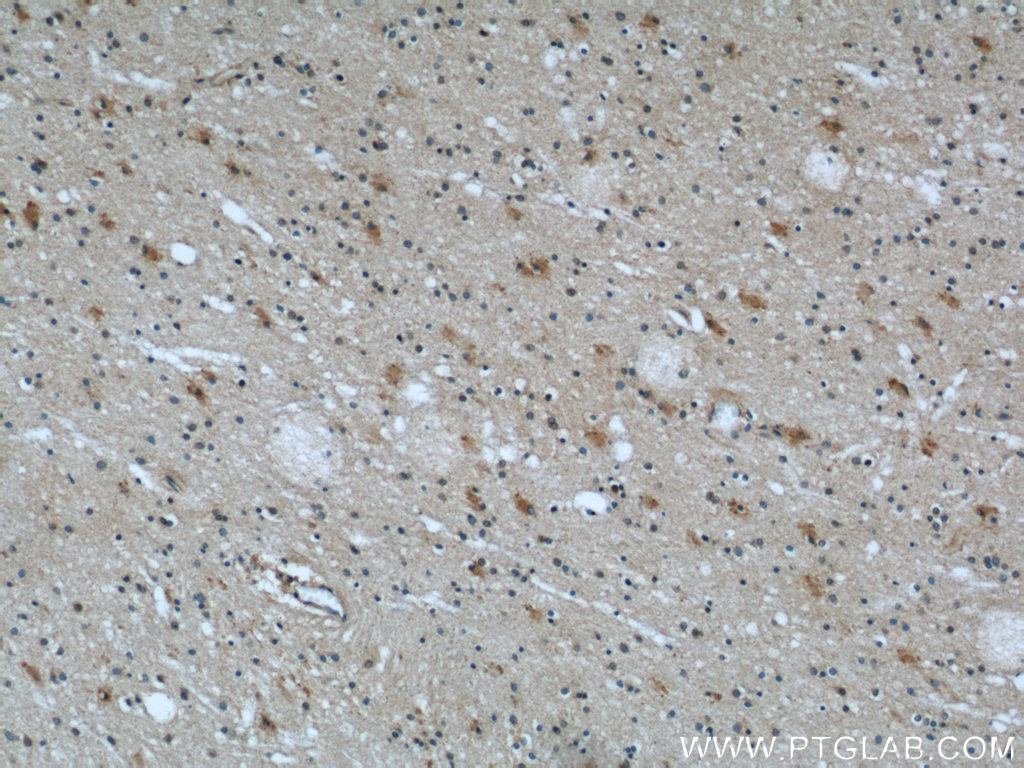 Immunohistochemistry (IHC) staining of human brain tissue using Kallikrein 11 Polyclonal antibody (12698-1-AP)