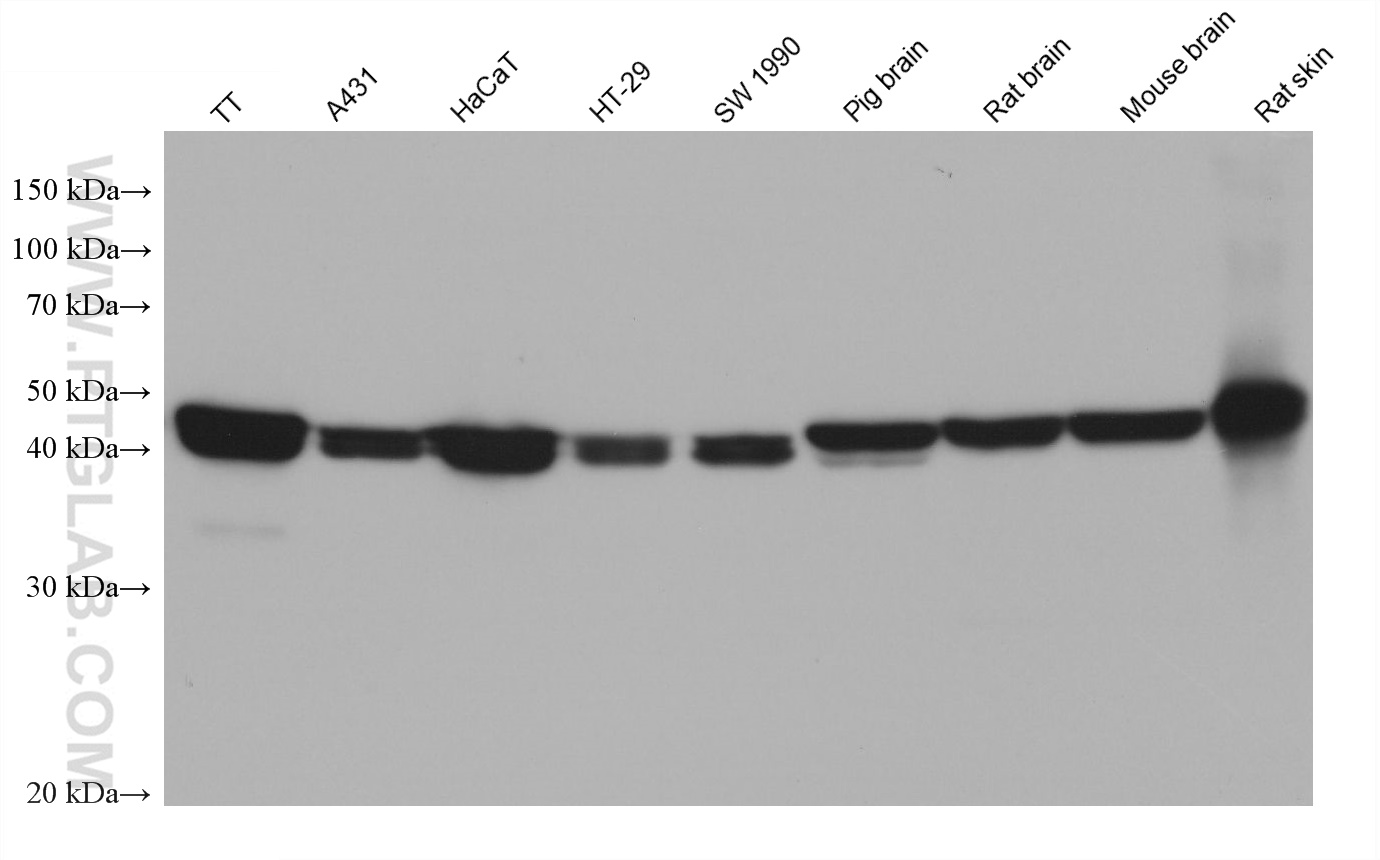 Western Blot (WB) analysis of various lysates using KLK11 Monoclonal antibody (67427-1-Ig)